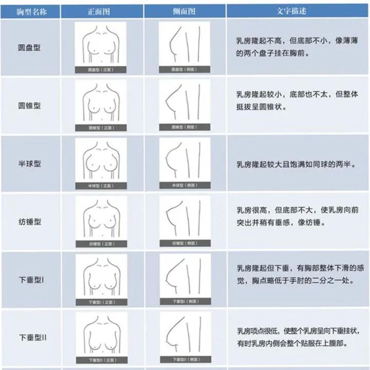 胸分几种类型？你是哪种呢